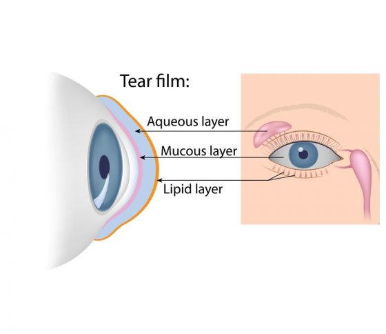 the components of the tear film in the eye to show what causes dry eye